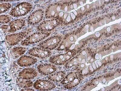 Immunohistochemistry-Paraffin: PDCD4 [p Ser457] Antibody [NBP3-13143] - PDCD4 (phospho Ser457) antibody detects PDCD4 (phospho Ser457) protein at nucleus in rat intestine by immunohistochemical analysis. Sample: Paraffin-embedded rat intestine. PDCD4 (phospho Ser457) antibody (NBP3-13143) diluted at 1:500. Antigen Retrieval: Citrate buffer, pH 6.0, 15 min